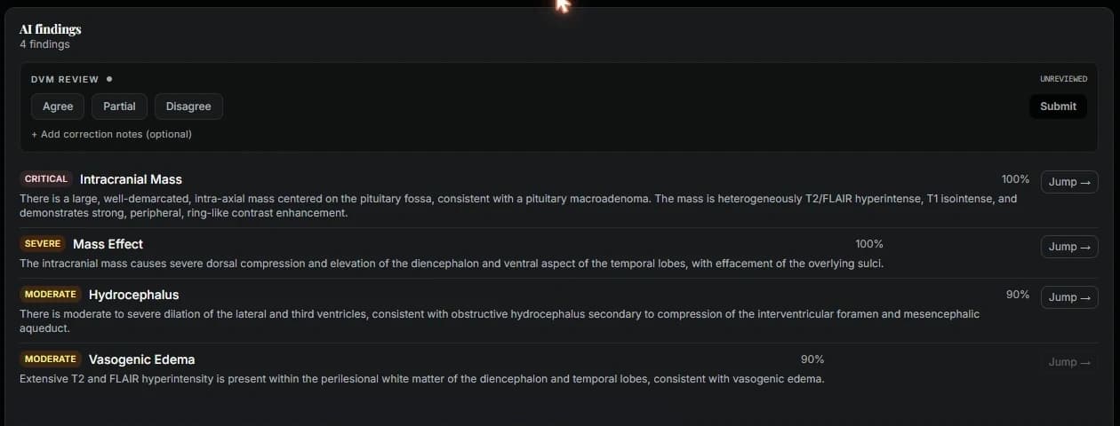 RosaVet AI findings panel for an MRI study, listing a critical intracranial mass at 100 percent confidence plus mass effect, hydrocephalus and vasogenic edema, above Agree, Partial and Disagree review buttons.